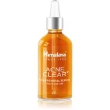 Acne Clear+ Scar Removal Serum regenerirajući serum za ožiljke 30 ml