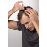 Crescina Transdermic 1300 Re-Growth and Anti-Hair Loss tretman rasta kose protiv ispadanja kose za muškarce výhodné balení | shoptok.hr