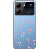  maska za ZTE Blade A54 Cute Bow Silikonska Print Skin | ePonuda.com