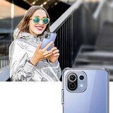 Techsuit Shockproof Clear Silicone prozirna maskica otporna na udarce za Xiaomi Mi 11 Lite 4G / Mi 11 Lite 5G / 11 Lite 5G NE | shoptok.hr