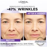 L´Oréal Paris Revitalift Filler serum protiv bora s hijaluronskom kiselinom 15 ml | shoptok.hr