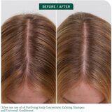 Biolage ScalpSync koncentrat za lasišče 200 ml | Shoptok.si