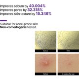 SOMEBYMI Retinol Intense Reactivating Serum serum z retinolom proti gubam za občutljivo kožo 50 ml | Shoptok.si
