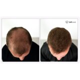 Uvi Hair lasna vlakna, DARK BROWN / Temno rjava (veliki 27.5 g, do 50 nanosov) | Shoptok.si