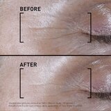 Filorga TIME-FILLER SHOT intenzivni serum proti prvim znakom staranja kože 15 ml | Shoptok.si