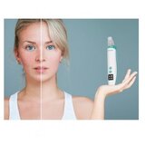 Beper P302VIS001 četka za čišćenje lica za proširene pore | shoptok.hr