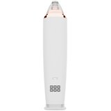 Beautifly B-Derma Ice Mikrodermoabrazija in odstranjevanje ogrcev | Shoptok.si