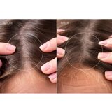 Foreo FAQ™ Scalp Recovery & Thick Hair Probiotic Serum probiotski serum za regeneraciju kose i vlasišta 60 ml | shoptok.hr