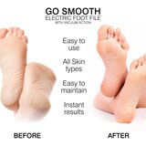 Rio Go Smooth Vacuum Action električna rašpa za stopala 1 kom | shoptok.hr