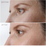 Foreo IRIS PM Serum za predeo oko očiju