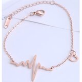 IZMAEL Zapestnica za noge EKG - Zlato Roza | Shoptok.si