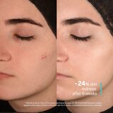 SKINSOO PurifyCell Exosome Serum regeneracijski serum za zmanjšanje por 50 ml | Shoptok.si