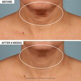 StriVectin Tighten & Lift TL Advanced Tightening Neck Cream Plus lifting krema za učvršćivanje za vrat i dekolte 50 ml | shoptok.hr