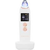 Beautifly B-Derma PRO Mikrodermoabrazija in odstranjevanje ogrcev Slike
