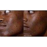 Omorovicza Elixir eliksir za ishranu i revitalizaciju kože lica 30 ml | shoptok.hr