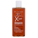 Xpel medicated šampon proti prhljaju 300 ml unisex