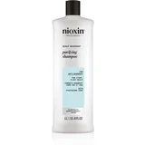 Scalp Recovery Purifying Shampoo šampon za redke lase brez volumna proti prhljaju 1000 ml