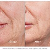 Silkn FaceTite Prestige naprava za glajenje in odpravo gub | Shoptok.si