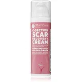 Recovery Cream krema protiv ožiljaka nakon carskog reza 50 ml