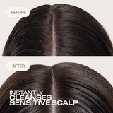 Goldwell Dualsenses Scalp Specialist Sensitive Foam Shampoo pjenasti šampon za osjetljivo vlasište 250 ml | shoptok.hr
