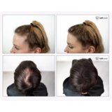 Uvi Hair lasna vlakna, DARK BROWN / Temno rjava (veliki 27.5 g, do 50 nanosov) | Shoptok.si