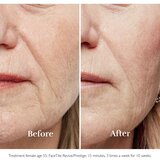 Silkn FaceTite Ritual uređaj za čišćenje lica protiv bora | shoptok.hr