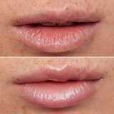 WONDERSKIN Lip Rehab Therapy Oil ulje za usne s hidratantnim učinkom nijansa Clear 3,57 ml | shoptok.hr