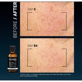 Filorga DAILY PEEL ANTI-DARK SPOT piling za obraz proti temnim madežem 50 ml | Shoptok.si