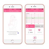  AngelSounds Mini FETAL DOPPLER z aplikacijo in ultrazvočnim gelom | Shoptok.si