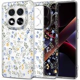 TECH-PROTECT OVITEK FLEXAIR ZA XIAOMI REDMI NOTE 14 PRO 5G POCO X7 5G ZAŠČITA, (5000086609) | Shoptok.si