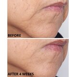 Perricone MD Cold Plasma Plus+ The Intensive Gel Mask gel maska za lice 59 ml | shoptok.hr