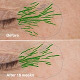 Clinique smart clinical repair wrinkle correcting serum serum protiv bora 50 ml | shoptok.hr