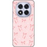  Torbica Silikonska Print za Xiaomi Redmi Note 14 Pro 5G (EU) Bow | ePonuda.com