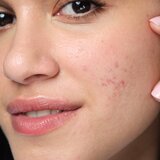 Neutrogena Clear & Defend+ Liquid Exfoliant tekući piling s aha kiselinama i pantenolom 125 ml unisex | shoptok.hr