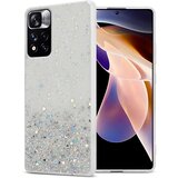 Cadorabo Ohišje, združljivo z Xiaomi RedMi NOTE 11 PRO+ in prozorna z bleščicami - Zaščitni ovitek iz prožnega silikona TPU s svetlečimi bleščicami, (20860126) | Shoptok.si