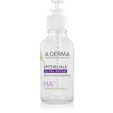 A-derma Epitheliale Ultra Repair HA+ Multi-Repairing Serum intenzivni regeneracijski serum s hialuronsko kislino 30 ml | Shoptok.si