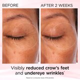 Elizabeth Arden Retinol + HPR Ceramide RAPID SKIN RENEWING EYE CREAM krema za zaglađivanje i posvjetljivanje područja oko očiju 15 ml | shoptok.hr