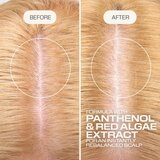 Goldwell Dualsenses Scalp Specialist Rebalance & Hydrate Fluid hidratantni fluid za obnovljanje vlasišta 150 ml | shoptok.hr