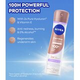 Nivea Derma Control Clinical Ultra Soft antiperspirant v pršilu 150 ml | Shoptok.si