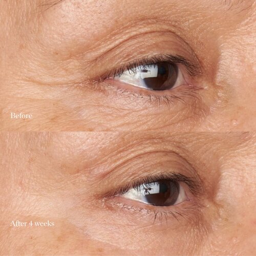 Perricone MD Hypoallergenic Clean Correction vlažilna in posvetlitvena nega za veke in kolobarje pod očmi 15 ml Slike