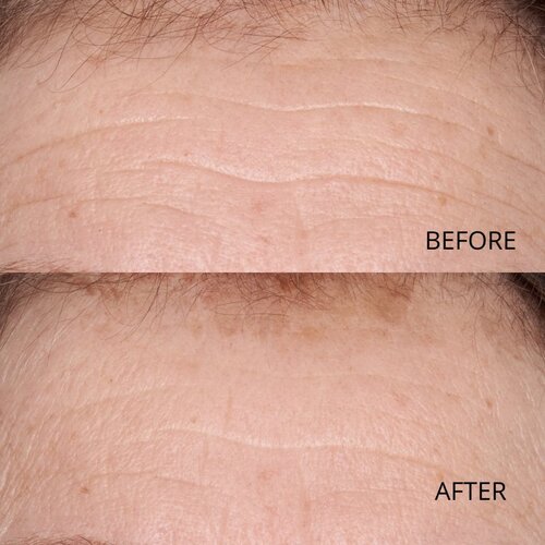 Perricone MD Hypoallergenic Clean Correction Smoothing Restorative Serum gladilni serum za hidracijo in posvetlitev kože 59 ml Slike