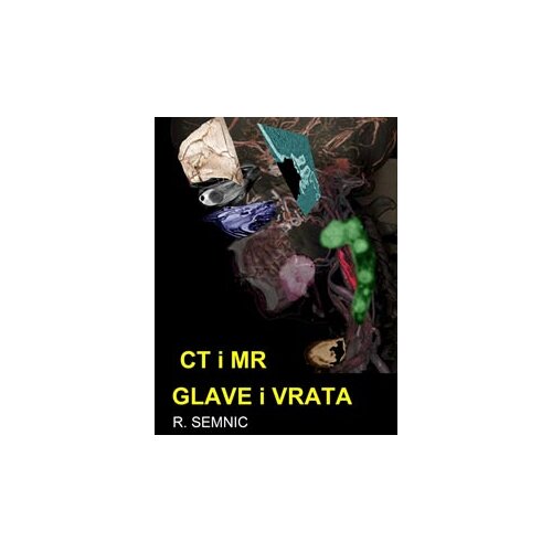 Donvas Robert Semnic
 - CT i MR glave i vrata Slike