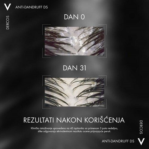 Vichy dercos anti - dandruff &amp;scaron;ampon protiv peruti za suvu kosu, 200 ml Slike
