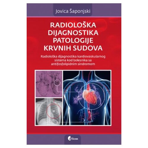 Službeni Glasnik Radiolo&amp;scaron;ka dijagnostika patologije krvnih sudova - Jovica &amp;Scaron;aponjski Slike