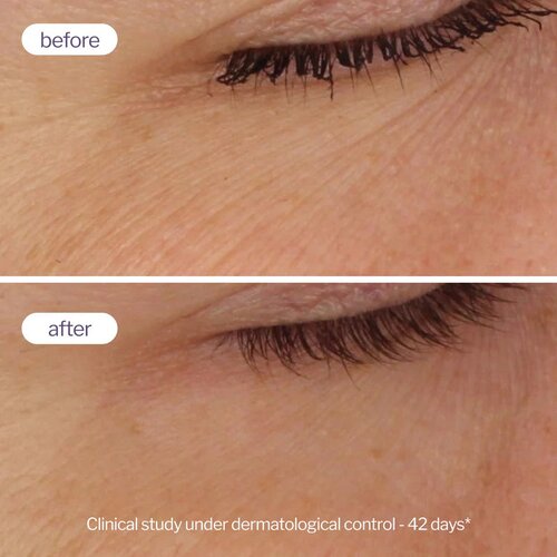Novexpert Pro-Retinol Dual Booster Serum &amp;ndash; Revolucija protiv bora Slike