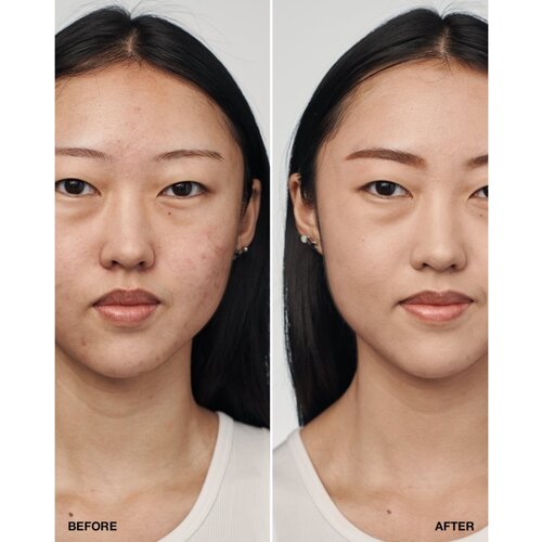 Clinique Even Better Clinical Serum Foundation SPF20 vlažilen in posveljujoč puder 30 ml odtenek CN28 Ivory (VF) Slike