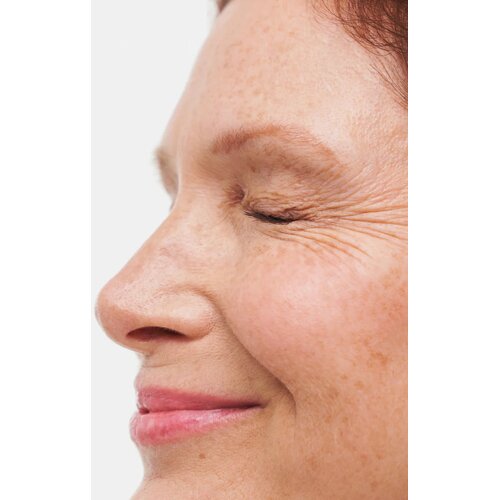 Novexpert Micellar Water with Hyaluronic Acid micelarna voda s hijaluronskom kiselinom 200 ml Slike