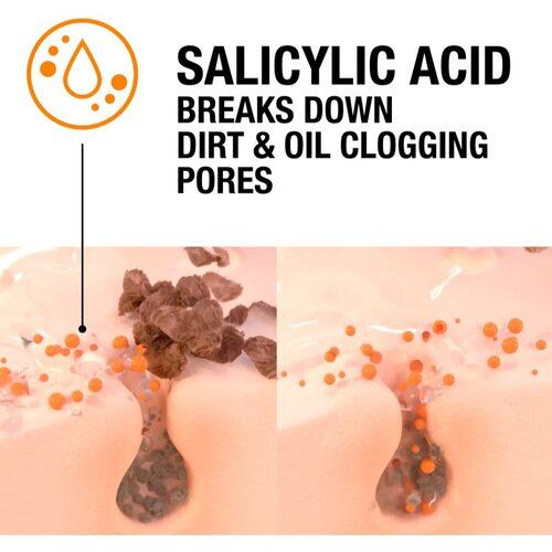 Neutrogena Blackhead Eliminating 2% Salicylic Acid Face Scrub piling protiv crnih točkica 150 ml unisex Slike