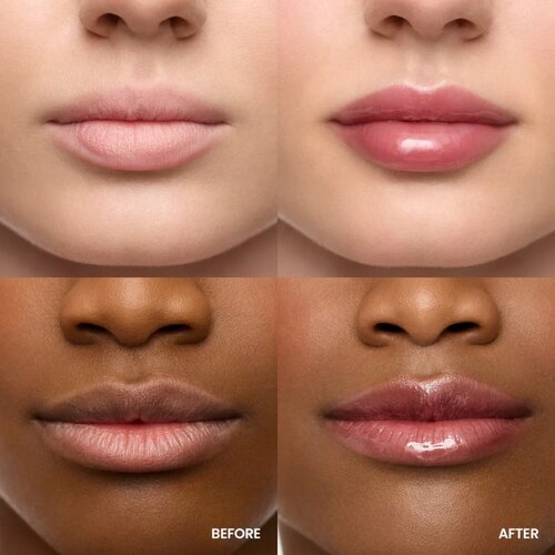 WONDERSKIN Lip Rehab Serum Oil olje za ustnice odtenek Honey 3.57 ml Slike