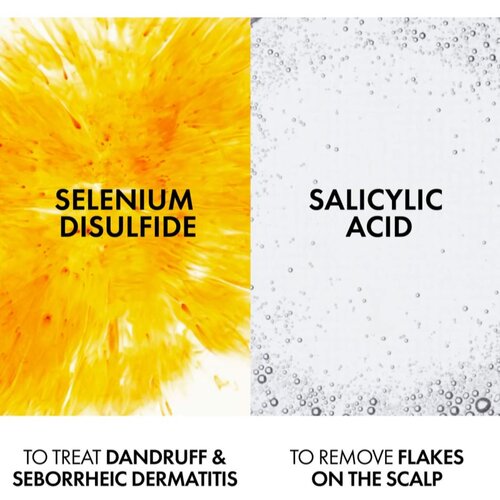 Vichy Dercos Anti-Dandruff &amp;scaron;ampon protiv peruti za suhu kosu 390 ml Slike
